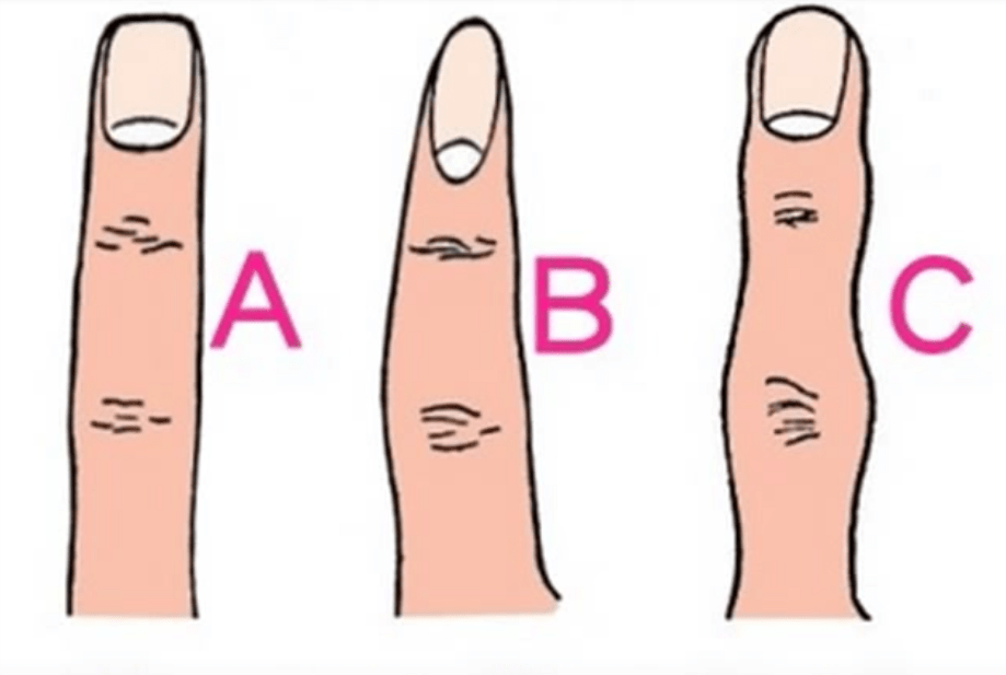 Welche Form haben deine Finger? Das sagt es über deine Persönlichkeit