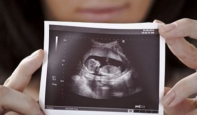 Ela pensava que sua gravidez havia terminado. Mas três semanas depois, os médicos descobriram algo inimaginável
